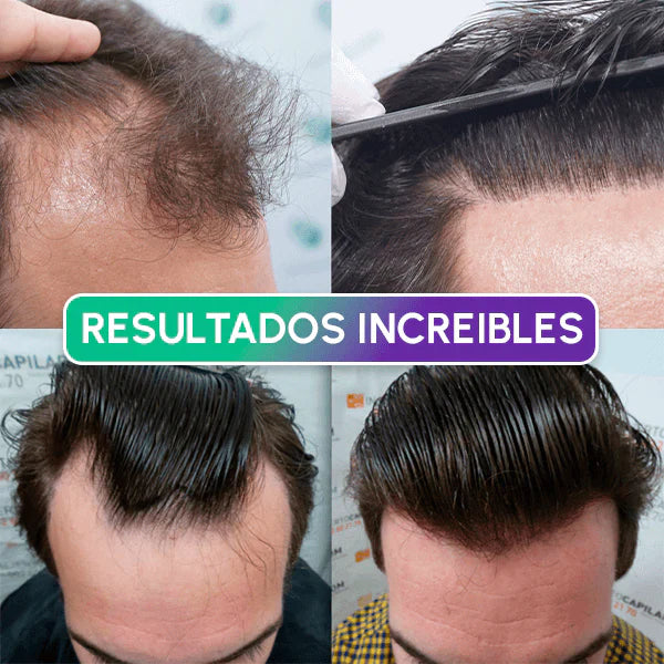 FIBRAS CAPILARES ADIOS CALVICIE Y CANAS+ENVIO GRATIS