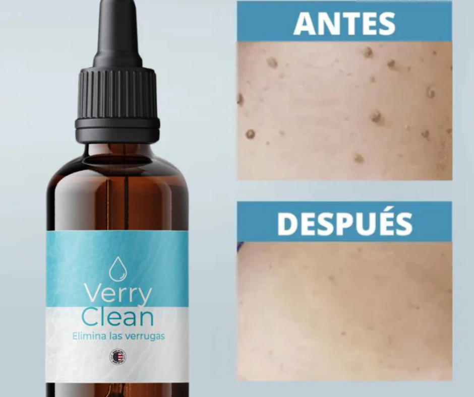 Elimina Verrugas con Verryclean+Envio Gratis